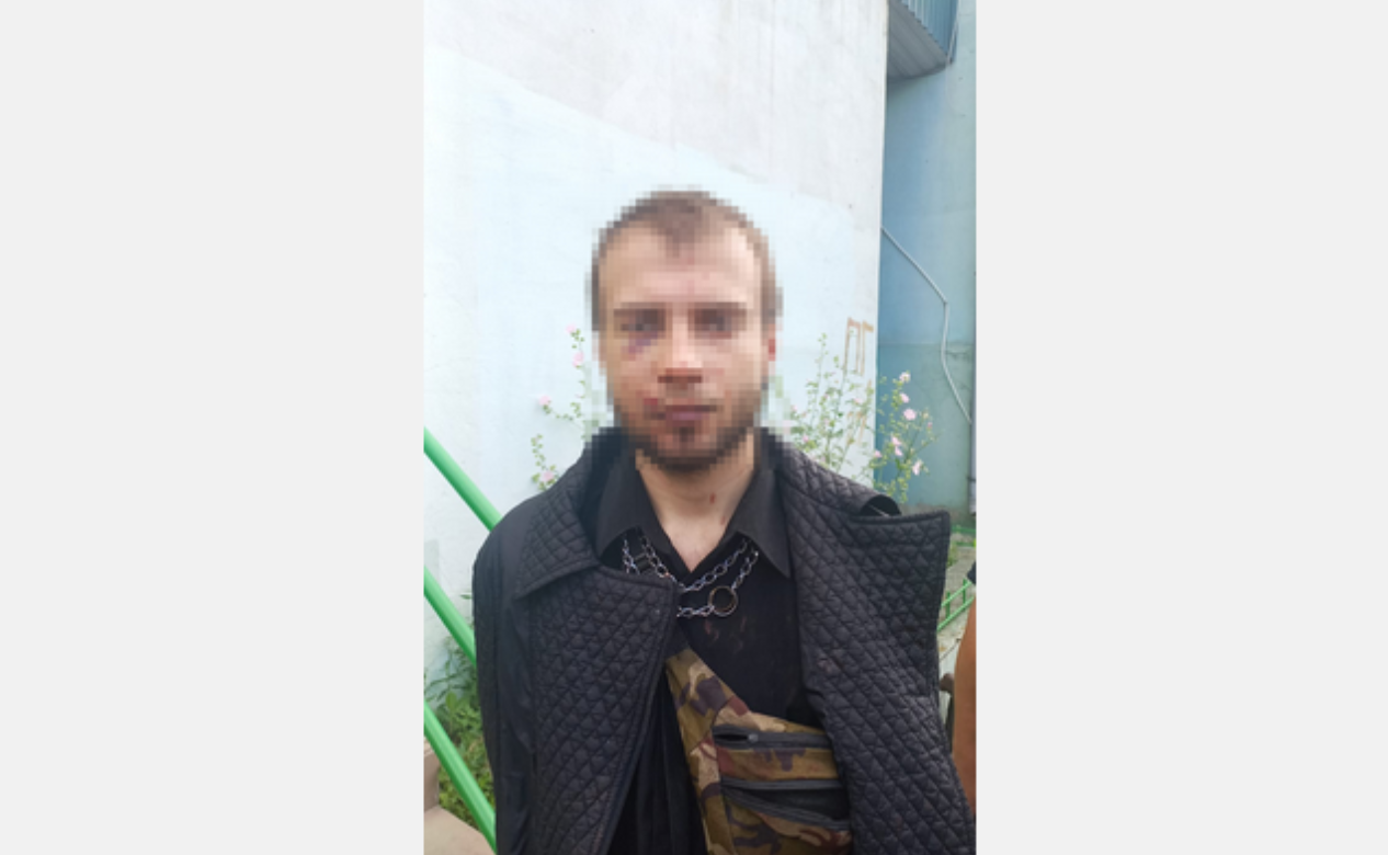 Убийца уже задержан. Фото: hk.npu.gov.ua